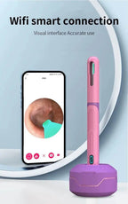 Camera Otoscope Earpick Set, USB C Charging Endoscope